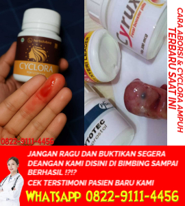 cara-menggugurkan-kandungan-di-apotik.jpg