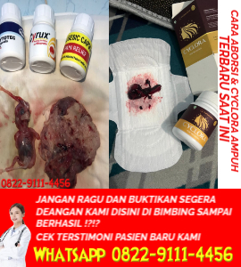 cara-menggugurkan-kandungan-dengan-obat-aborsi-cytotec-usia-12345678-bulan.jpg