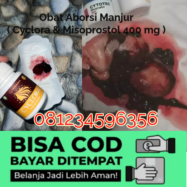 cara-mempercepat-menstruasi